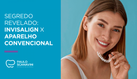  Segredo revelado: Invisalign X Aparelho convencional
