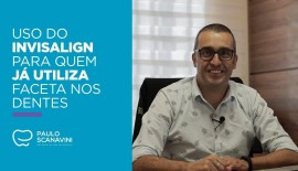 Uso do Invisalign para quem já utiliza faceta nos dentes