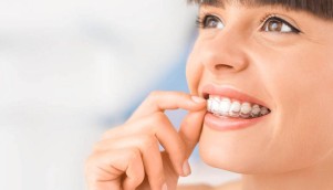 Quanto tempo demora o tratamento com o Invisalign?