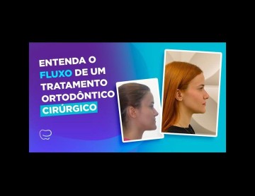 Entenda o fluxo de um tratamento ortodôntico cirúrgico