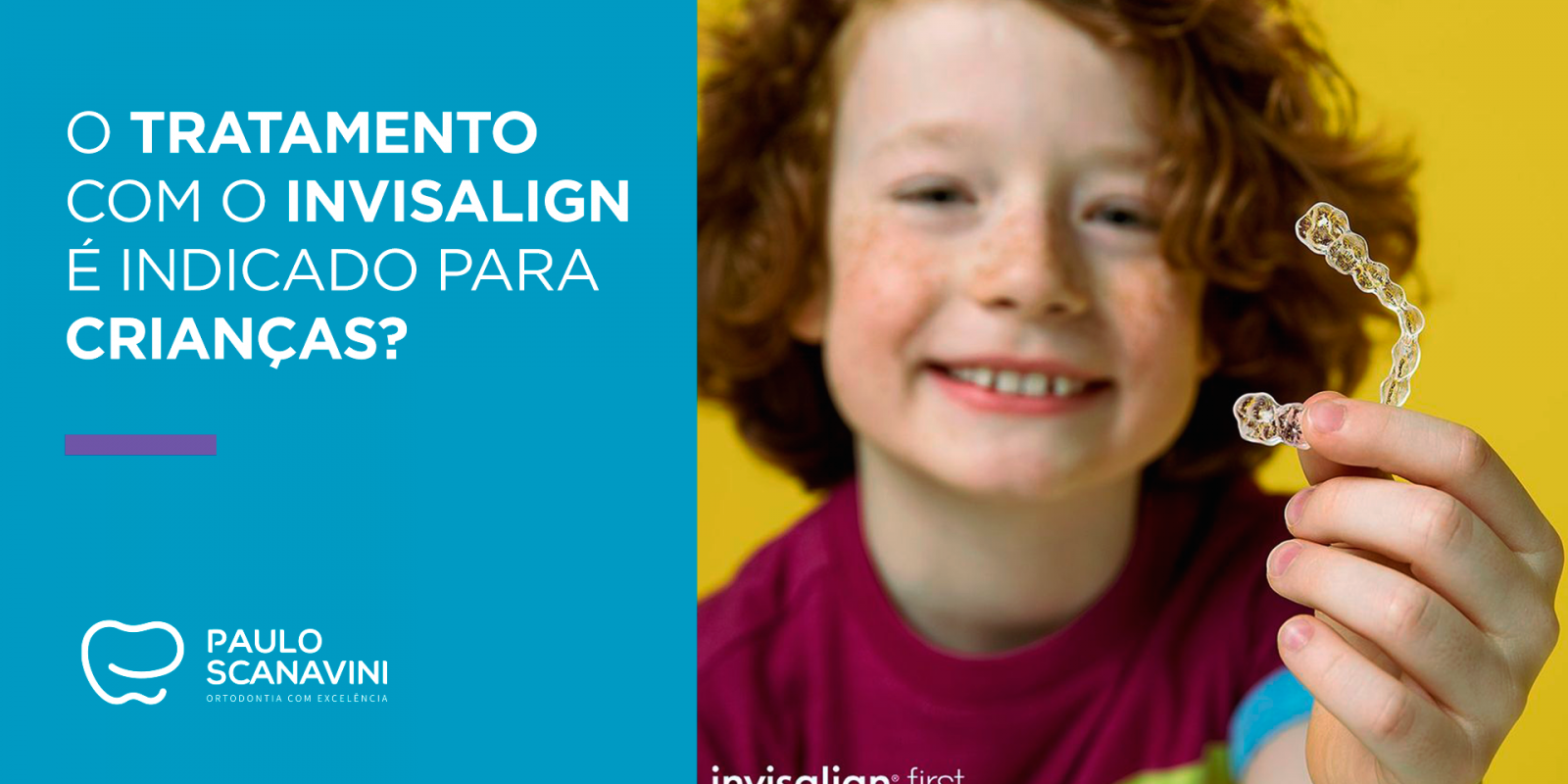 O tratamento com o Invisalign é indicado para crianças?