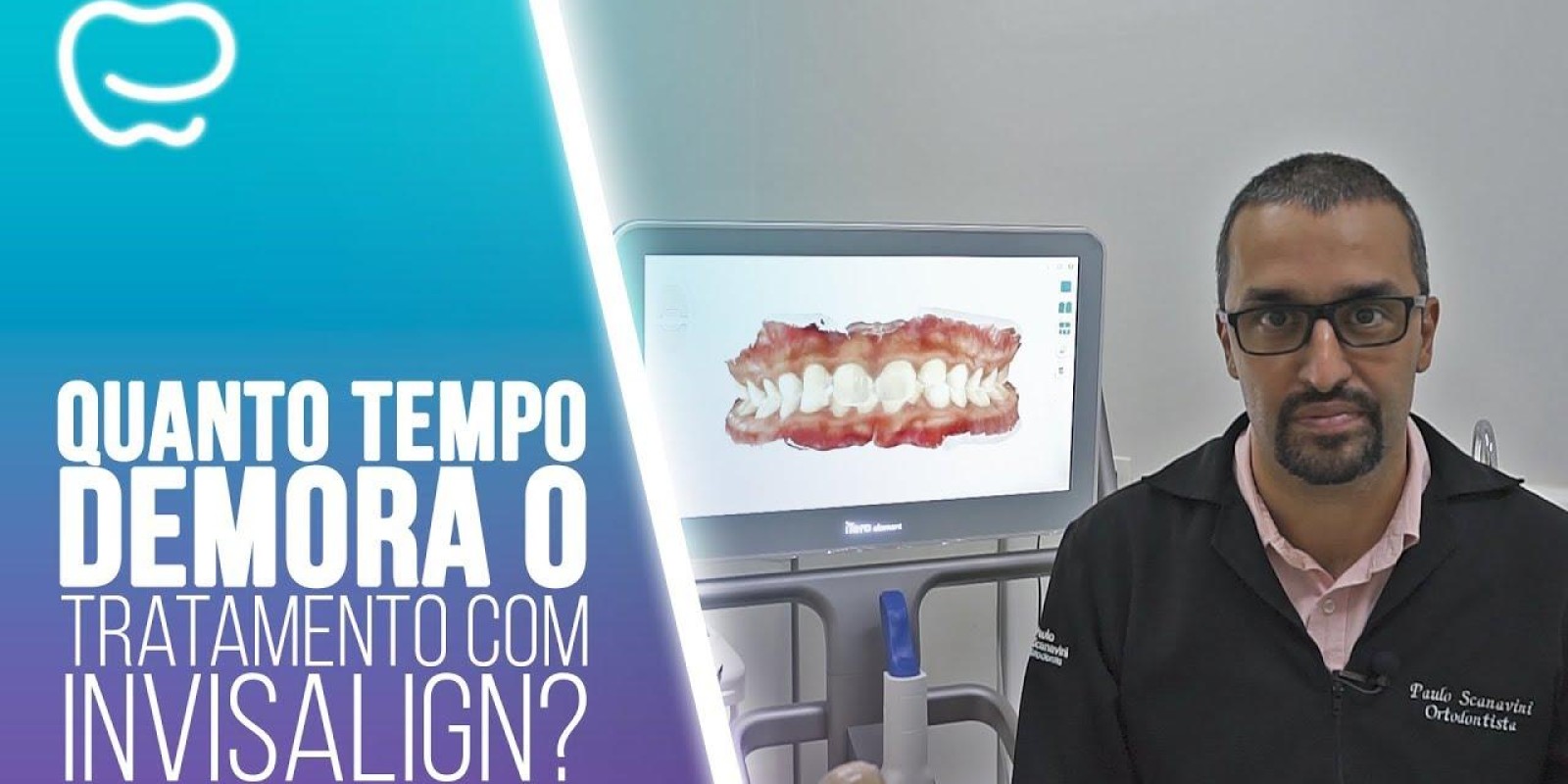 Quanto tempo demora o tratamento com Invisalign?