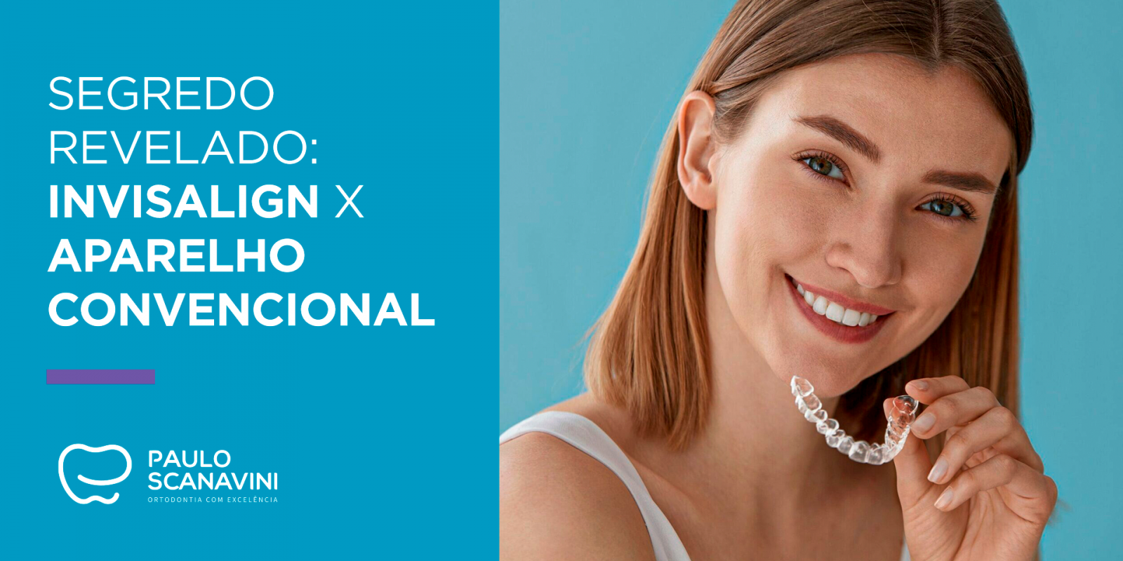  Segredo revelado: Invisalign X Aparelho convencional