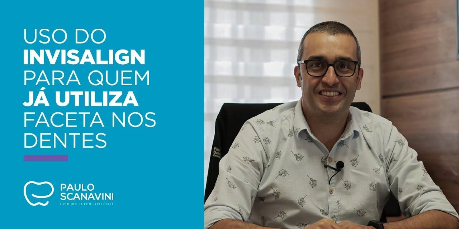 Uso do Invisalign para quem já utiliza faceta nos dentes